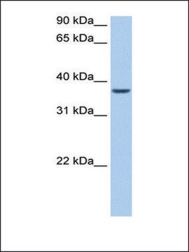 Anti-ALKBH8 antibody produced in rabbit affinity isolated antibody