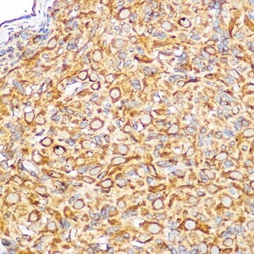 Anti- KEAP1 antibody produced in rabbit