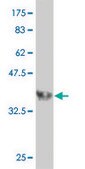 Monoclonal Anti-PPP3R2 antibody produced in mouse clone 5D9, purified immunoglobulin, buffered aqueous solution