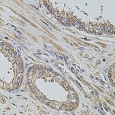 Anti-ALIX/PDCD6IP antibody produced in rabbit
