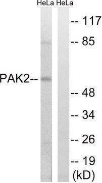 Anti-PAK2 antibody produced in rabbit affinity isolated antibody