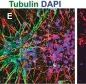 Anti-Tubulin Antibody, beta III isoform, CT, clone TU-20 (Similar to TUJ1) ascites fluid, clone TU-20 (Similar to TUJ1), Chemicon&#174;
