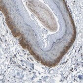 Anti-SLC43A1 antibody produced in rabbit Prestige Antibodies&#174; Powered by Atlas Antibodies, affinity isolated antibody, buffered aqueous glycerol solution