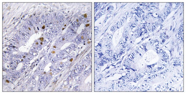 Anti-Nuclear Receptor NR4A1 antibody produced in rabbit affinity isolated antibody