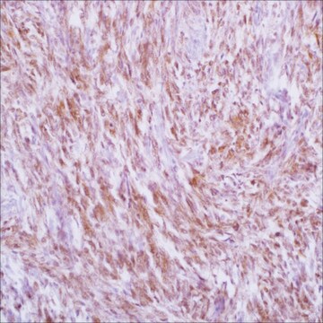 CITED1 (5H6) Mouse Monoclonal Antibody