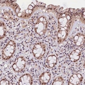Anti-CDYL2 antibody produced in rabbit Prestige Antibodies&#174; Powered by Atlas Antibodies, affinity isolated antibody, buffered aqueous glycerol solution
