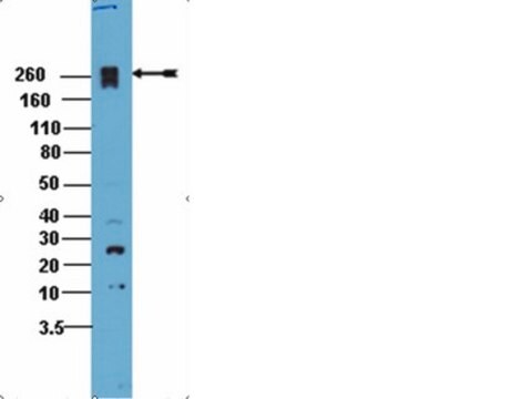 Anti-PEAK1 Antibody from rabbit, purified by affinity chromatography