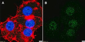 Anti-PPAR&#948; Antibody, clone 1I8 ZooMAb&#174; Rabbit Monoclonal recombinant, expressed in HEK 293 cells