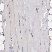 Anti-Anti-PTGS1 antibody produced in rabbit Prestige Antibodies&#174; Powered by Atlas Antibodies, affinity isolated antibody, buffered aqueous glycerol solution