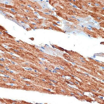 Anti-NDUFB8 antibody produced in rabbit