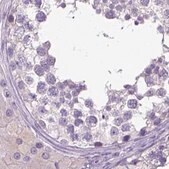 Anti-LGSN antibody produced in rabbit Prestige Antibodies&#174; Powered by Atlas Antibodies, affinity isolated antibody, buffered aqueous glycerol solution