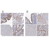 Anti-SLC9A3 antibody produced in rabbit Prestige Antibodies&#174; Powered by Atlas Antibodies, affinity isolated antibody, buffered aqueous glycerol solution