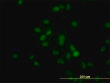 Monoclonal Anti-HDAC1 antibody produced in mouse clone 5C11, purified immunoglobulin, buffered aqueous solution