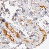 Anti-TF antibody produced in rabbit Ab1, Prestige Antibodies&#174; Powered by Atlas Antibodies, affinity isolated antibody, buffered aqueous glycerol solution