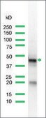 Anti-Keratin 17 antibody, Rabbit monoclonal recombinant, expressed in proprietary host, clone SP95, affinity isolated antibody
