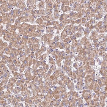 Anti-TYW5 antibody produced in rabbit Prestige Antibodies&#174; Powered by Atlas Antibodies, affinity isolated antibody, buffered aqueous glycerol solution