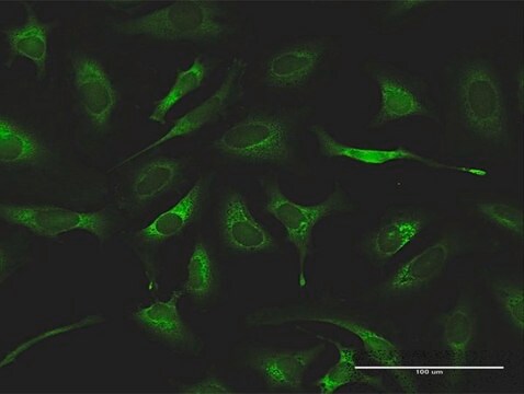 Anti-QARS antibody produced in rabbit purified immunoglobulin, buffered aqueous solution