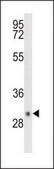 ANTI-DIO3 (C-TERM) antibody produced in rabbit IgG fraction of antiserum, buffered aqueous solution