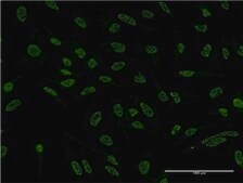 Monoclonal Anti-BCL11A antibody produced in mouse clone 3D9, purified immunoglobulin, buffered aqueous solution