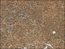 Anti-TGM7 affinity isolated antibody