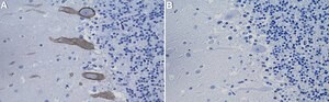 Anti-PKC&#947; Antibody, clone 2B9 ZooMAb&#174; Rabbit Monoclonal recombinant, expressed in HEK 293 cells