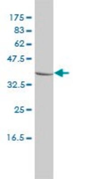 Monoclonal Anti-CTBS antibody produced in mouse clone 1B5-1B9, purified immunoglobulin, buffered aqueous solution