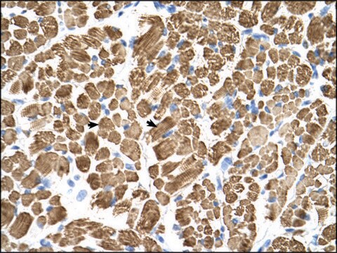 Anti-TPM2 antibody produced in rabbit IgG fraction of antiserum