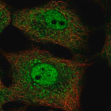 Anti-NFKBIB antibody produced in rabbit Prestige Antibodies&#174; Powered by Atlas Antibodies, affinity isolated antibody