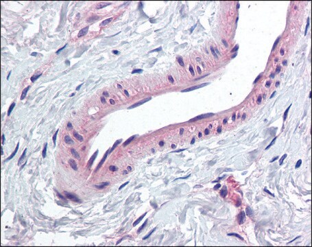 Anti-KCNMA1 antibody produced in rabbit affinity isolated antibody