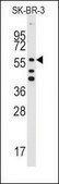 Anti-ALDH5A1 (N-term) antibody produced in rabbit affinity isolated antibody, buffered aqueous solution