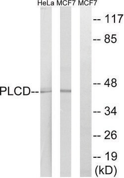 Anti-AGPAT4 antibody produced in rabbit affinity isolated antibody