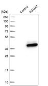 Anti-AGMAT antibody produced in rabbit Prestige Antibodies&#174; Powered by Atlas Antibodies, affinity isolated antibody, buffered aqueous glycerol solution
