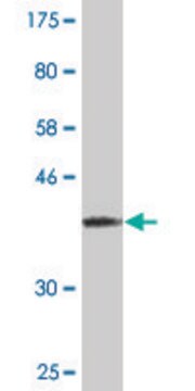 Monoclonal Anti-RPS17 antibody produced in mouse clone 1B11, purified immunoglobulin, buffered aqueous solution