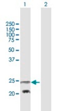 Anti-PEMT antibody produced in mouse purified immunoglobulin, buffered aqueous solution