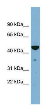 Anti-TAPBP antibody produced in rabbit affinity isolated antibody