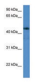 Anti-ADORA2A (C-terminal) antibody produced in rabbit affinity isolated antibody