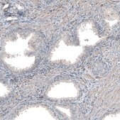 Anti-COL1A1 antibody produced in rabbit Prestige Antibodies&#174; Powered by Atlas Antibodies, affinity isolated antibody, buffered aqueous glycerol solution