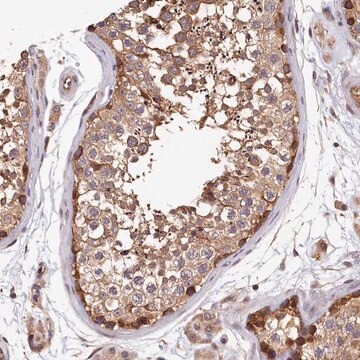 Anti-TMEM116 antibody produced in rabbit affinity isolated antibody, buffered aqueous glycerol solution