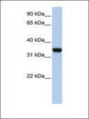 Anti-LDHA affinity isolated antibody