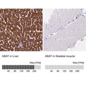Anti-ABAT antibody produced in rabbit Prestige Antibodies&#174; Powered by Atlas Antibodies, affinity isolated antibody, buffered aqueous glycerol solution