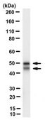 Anti-nonphospho-Ser9/21 GSK3&#946;/&#945; Antibody, clone 15C2 clone 15C2, from mouse