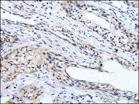 Anti-LINGO1 affinity isolated antibody