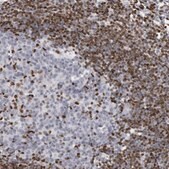 Anti-MECP2 antibody produced in rabbit Ab2, Prestige Antibodies&#174; Powered by Atlas Antibodies, affinity isolated antibody, buffered aqueous glycerol solution