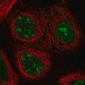 Anti-NCL antibody produced in rabbit Prestige Antibodies&#174; Powered by Atlas Antibodies, affinity isolated antibody, buffered aqueous glycerol solution
