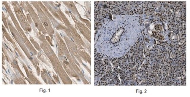 Anti-PQBP1 Antibody from rabbit, purified by affinity chromatography