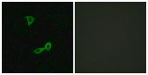 Anti-GRM2 antibody produced in rabbit affinity isolated antibody