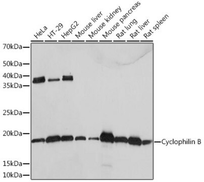 Anti-Cyclophilin B Antibody, clone 7Z4S7, Rabbit Monoclonal