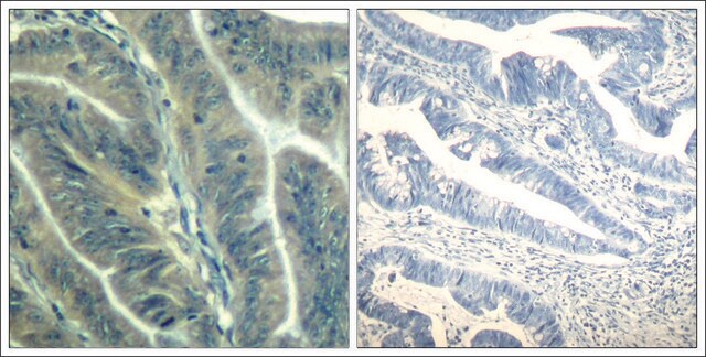 Anti-CDK6 (Ab-24) antibody produced in rabbit affinity isolated antibody