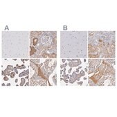 Anti-SERPINA1 antibody produced in rabbit Prestige Antibodies&#174; Powered by Atlas Antibodies, affinity isolated antibody, buffered aqueous glycerol solution