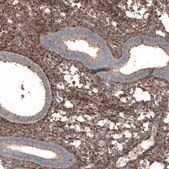 Anti-COL1A1 antibody produced in rabbit Prestige Antibodies&#174; Powered by Atlas Antibodies, affinity isolated antibody, buffered aqueous glycerol solution